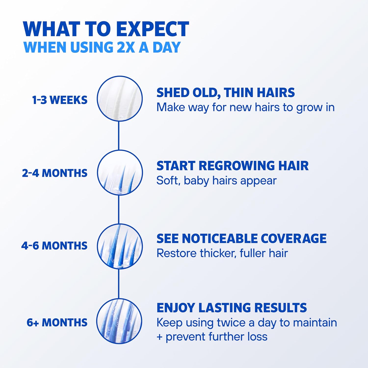 Men’s Rogaine 5% Minoxidil Topical Foam, One Month Supply